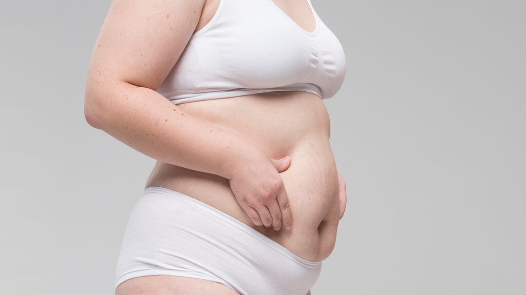 Lipoaspiração e a segurança na hora de realizar o procedimento